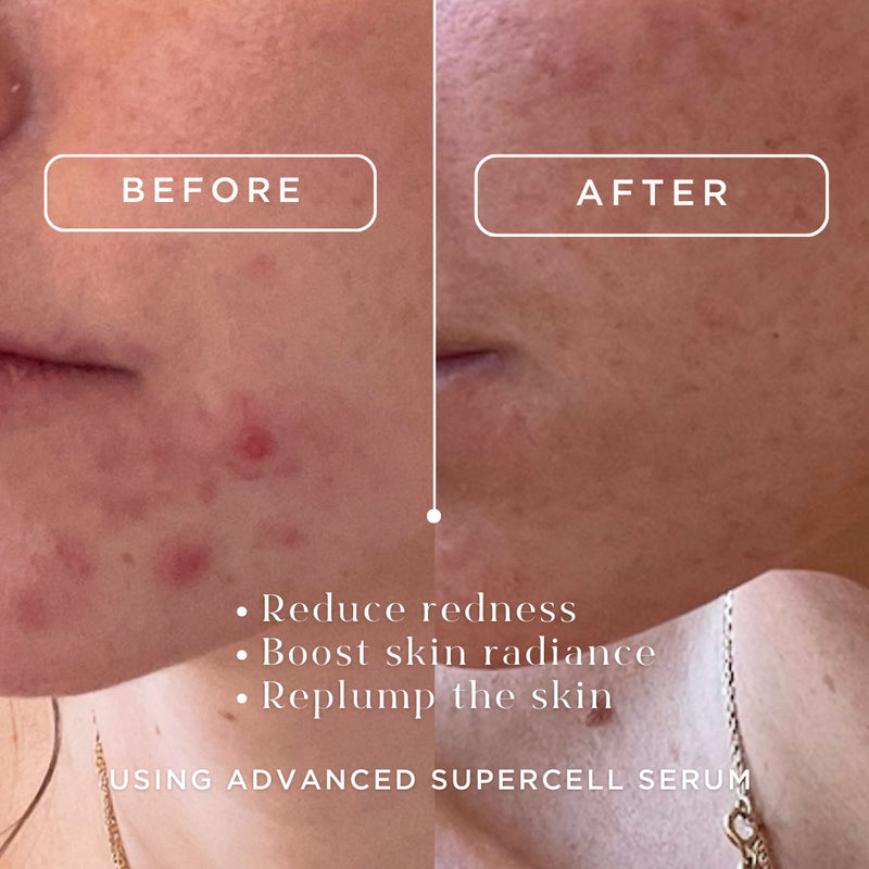 Advanced Supercell Serum