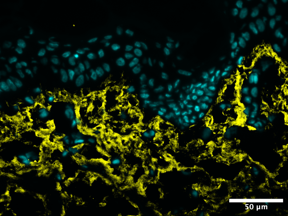 Microscope image showing collagen I levels before UV-A stress on untreated skin