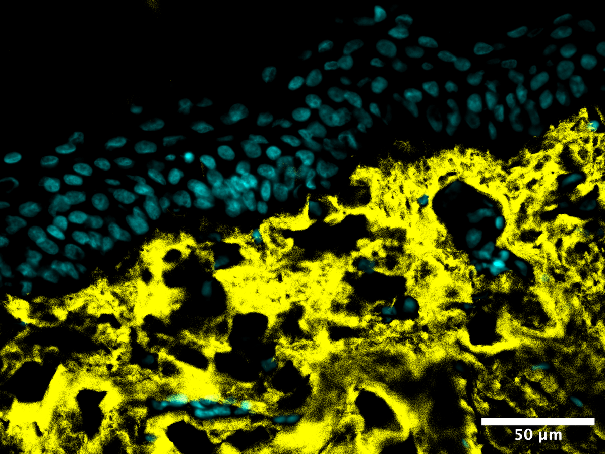 Microscope image showing reduced collagen damage after Peptide Longevity Serum


