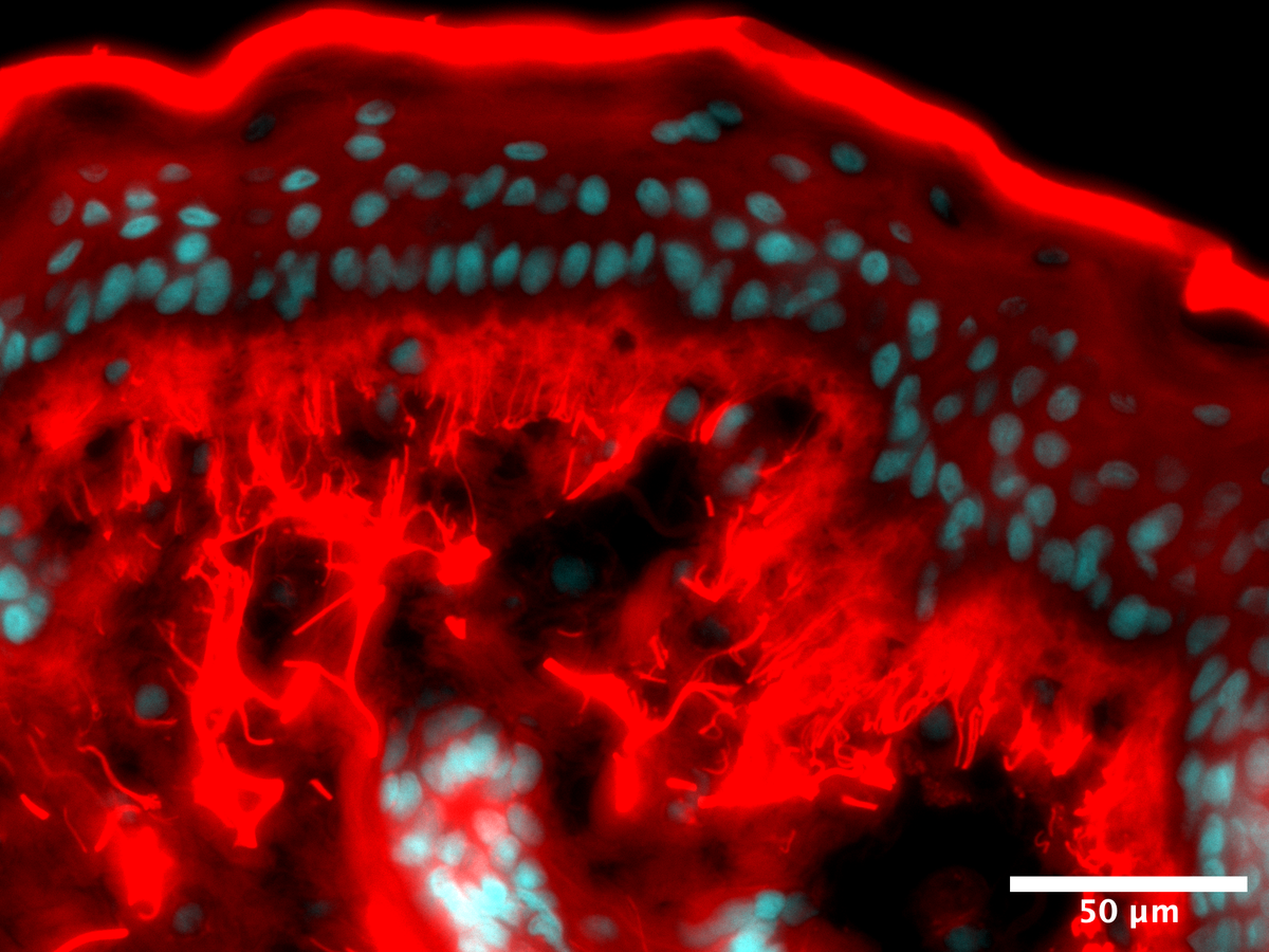 Microscope image showing UV-A stress on  untreated skin