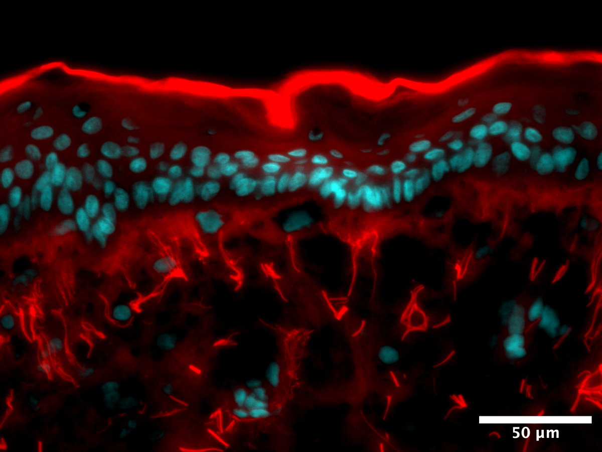 Microscope image showing reduced protein damage after Peptide Longevity Serum
