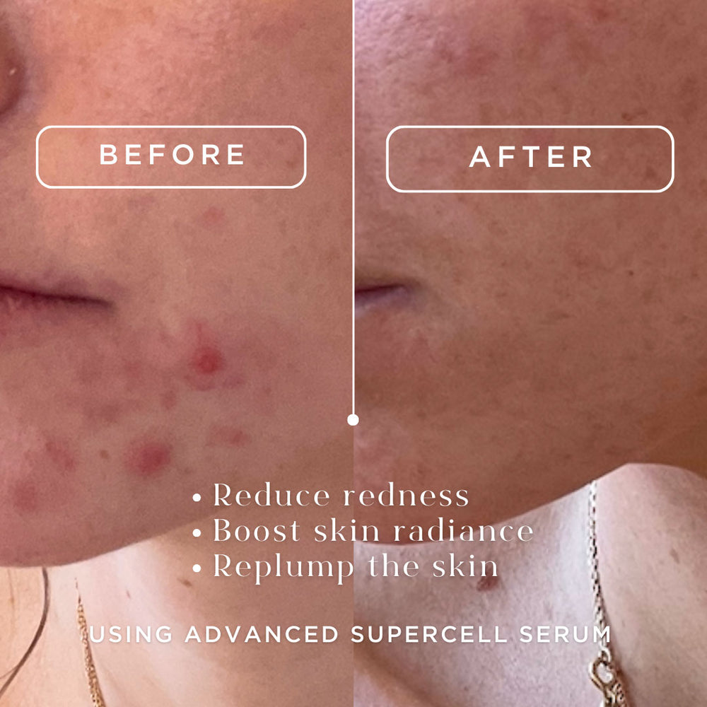 Winter Skin Glow Duo